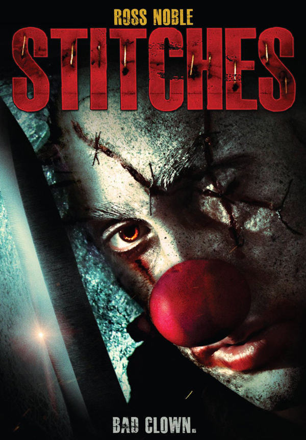 stitches